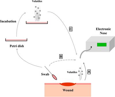 Supporting wound infection diagnosis: advancements and challenges with electronic noses